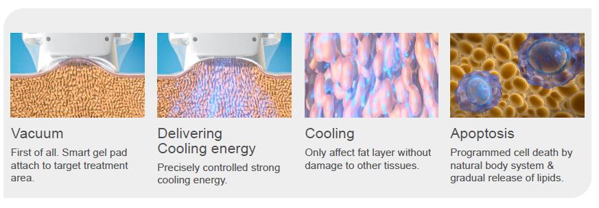 QQ截图20180424170647