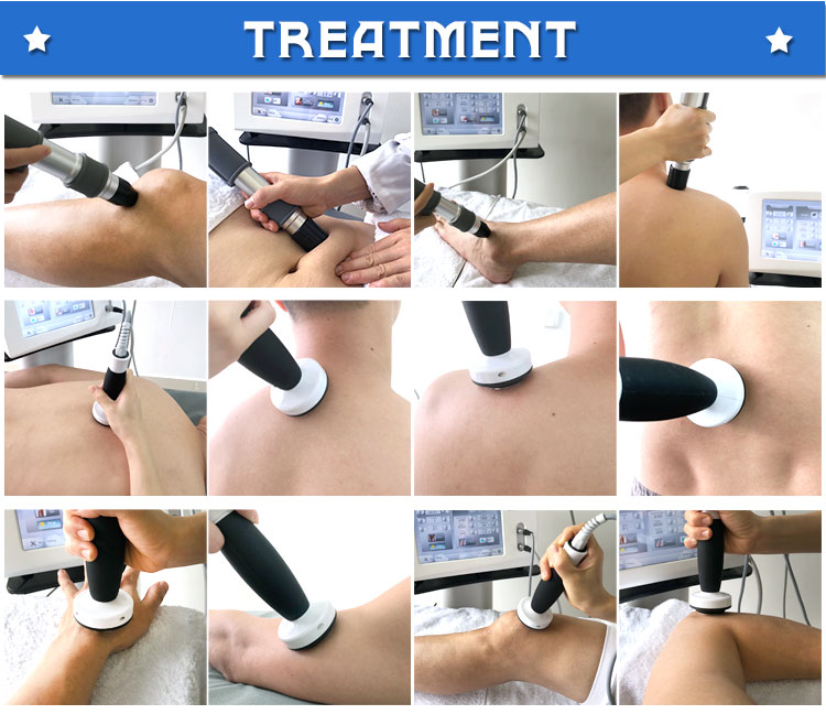 shockwave physiotherapy treatment 