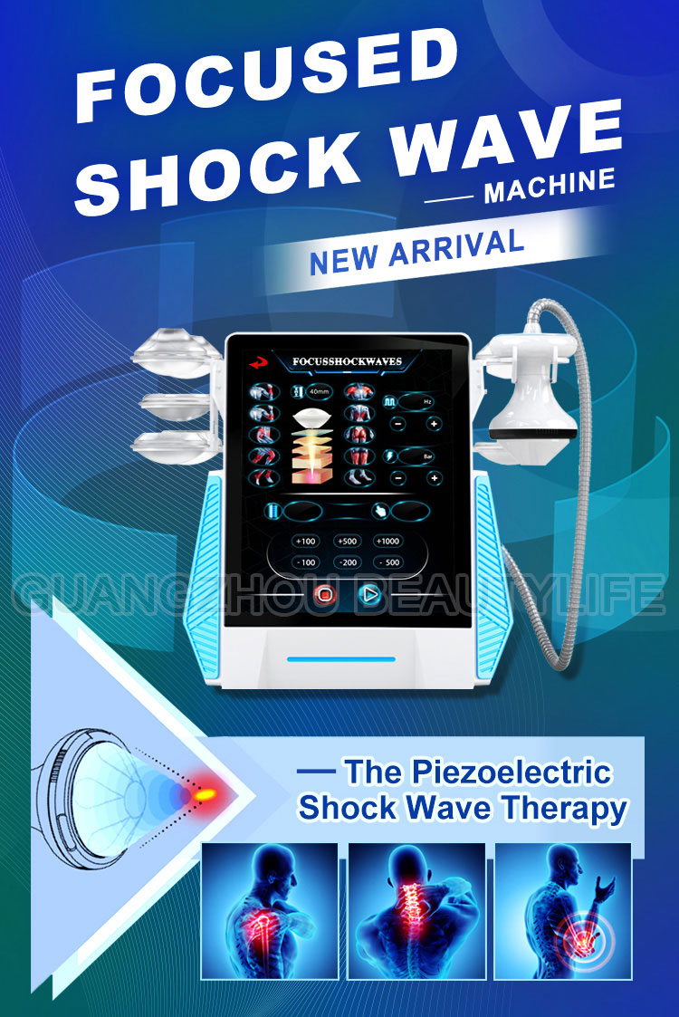 focused shockwave therapy 
