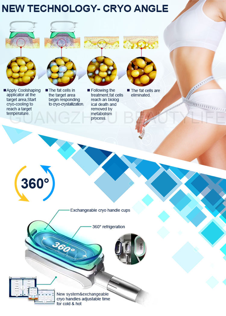 cryolipolysis coolshaping