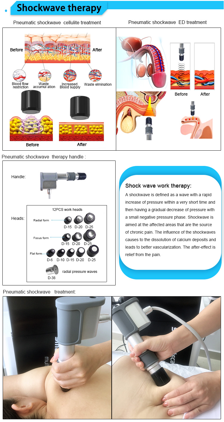 shockwave therapy