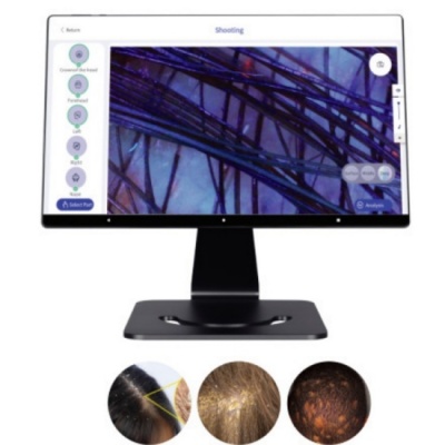Smart ai scalp analysis aesthetic machine