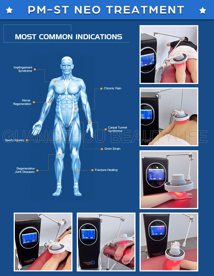 pmst pain therapy