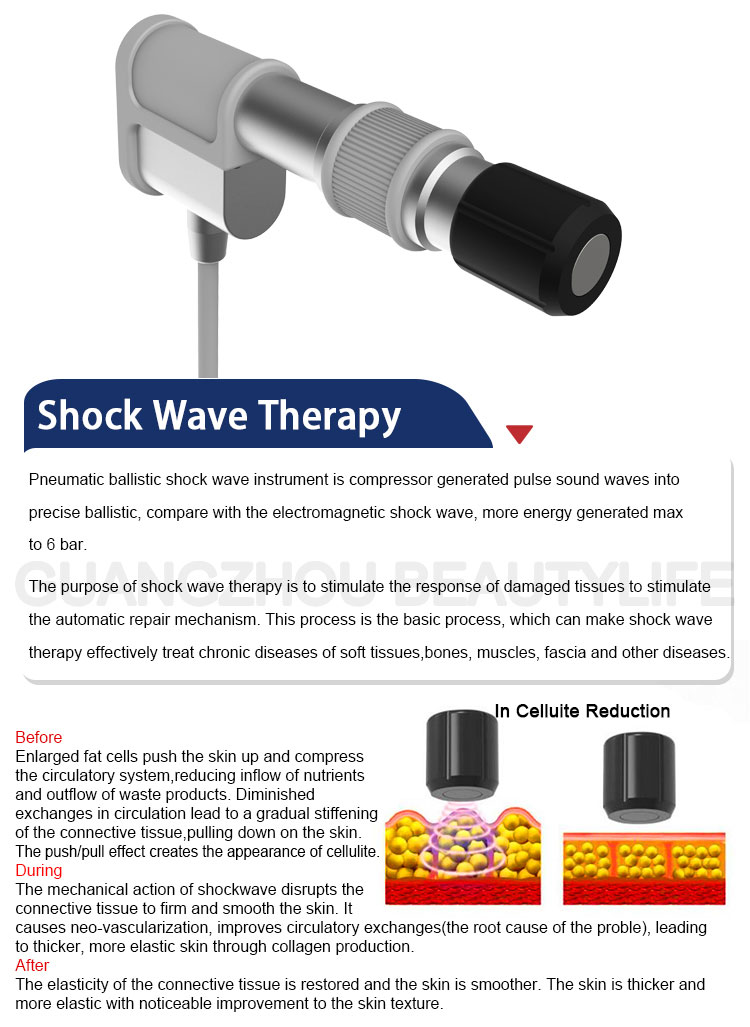 shockwave therapy machine