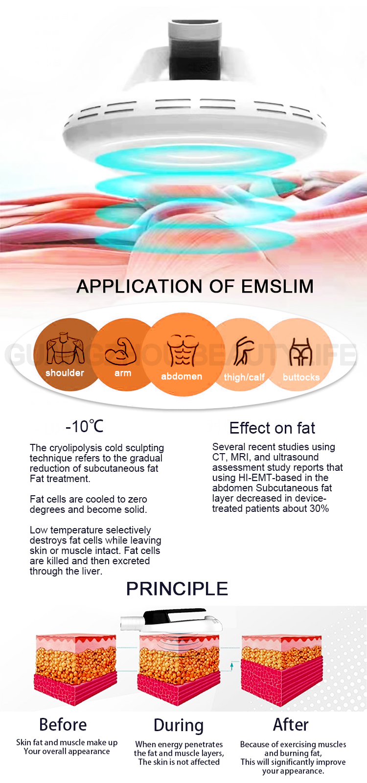 cryolipolysis emslim neo