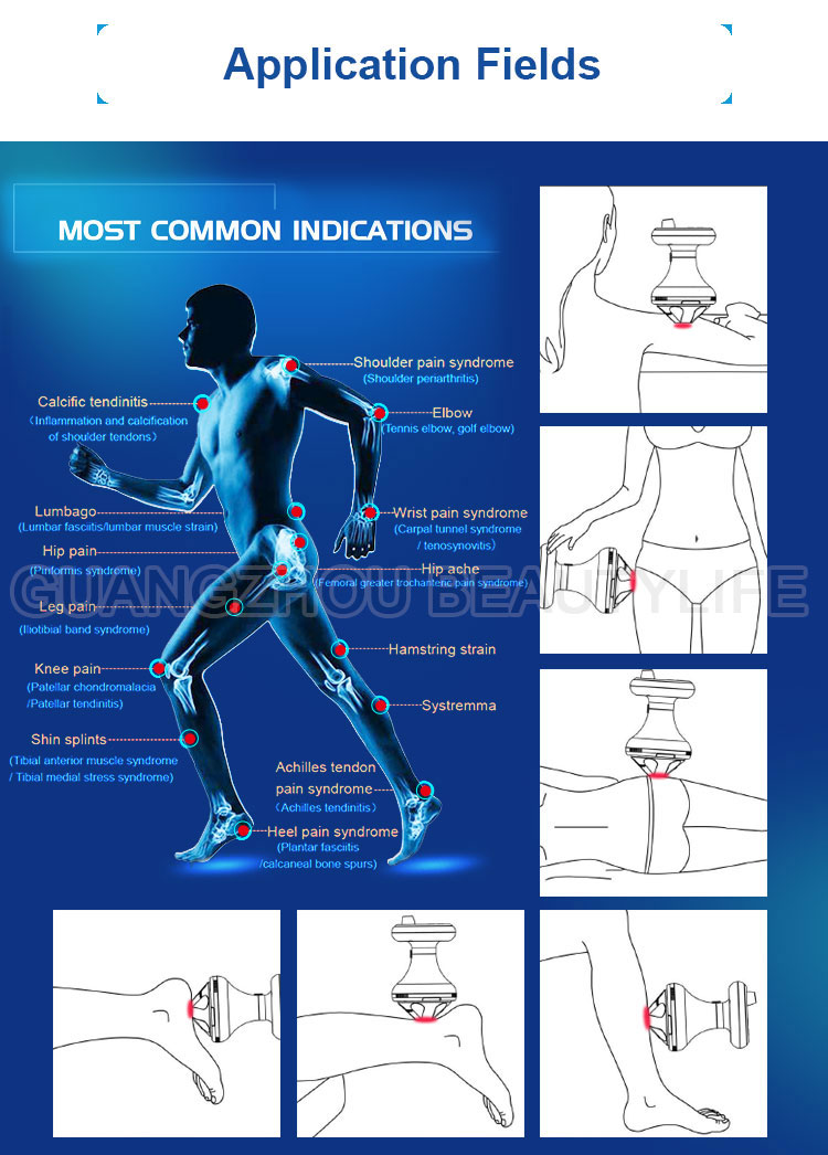 focus shockwave therapy 