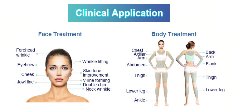 hifu treatment