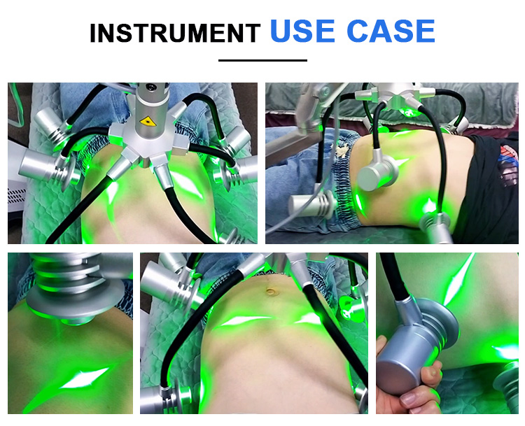 laser equipment treatment