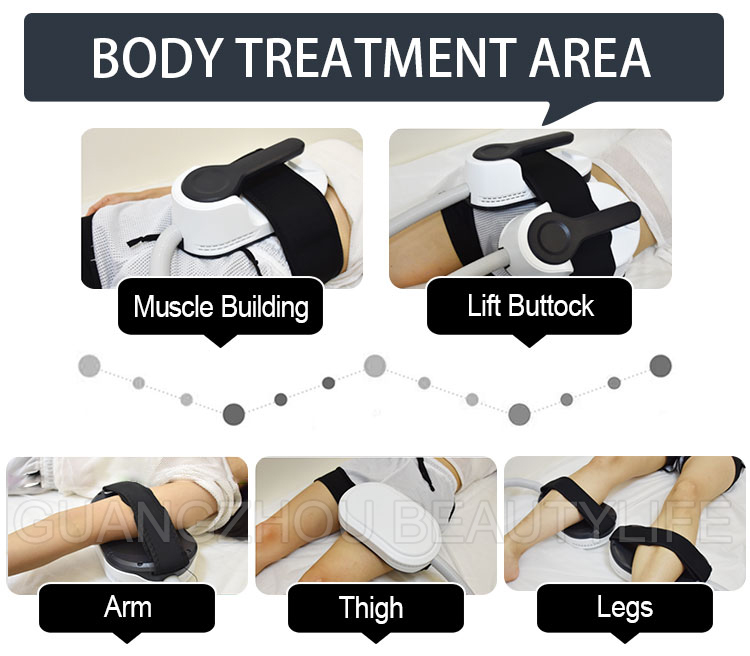 hiemt emsculpt treatment