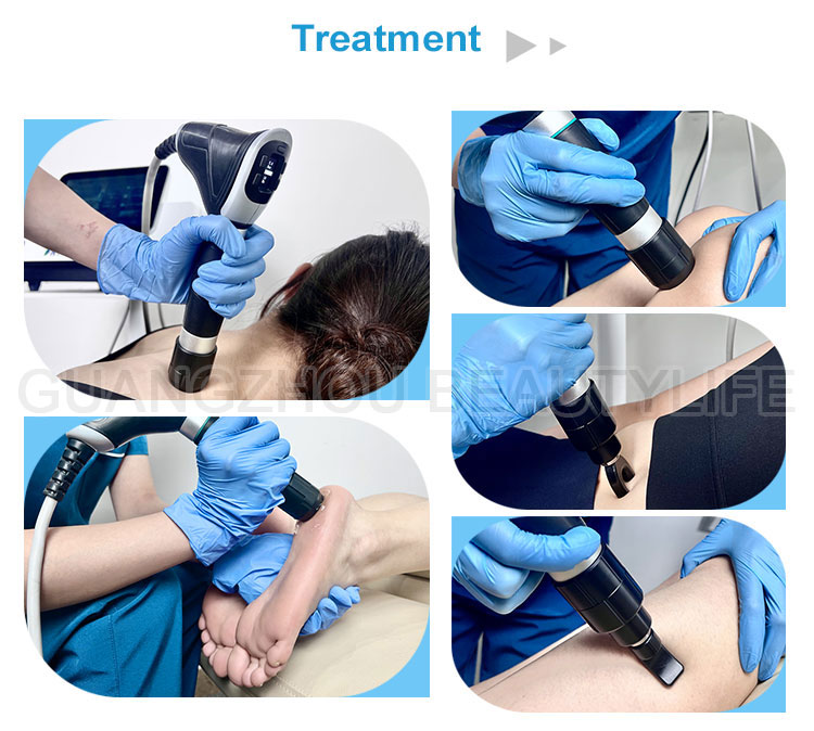 pneumatic shockwave therapy