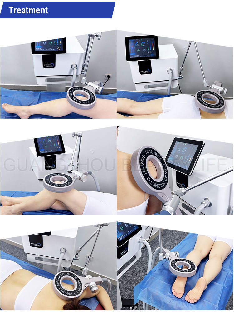 pemf machine treatment