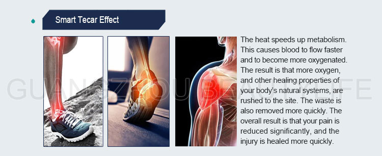 tecar rf machine treatment