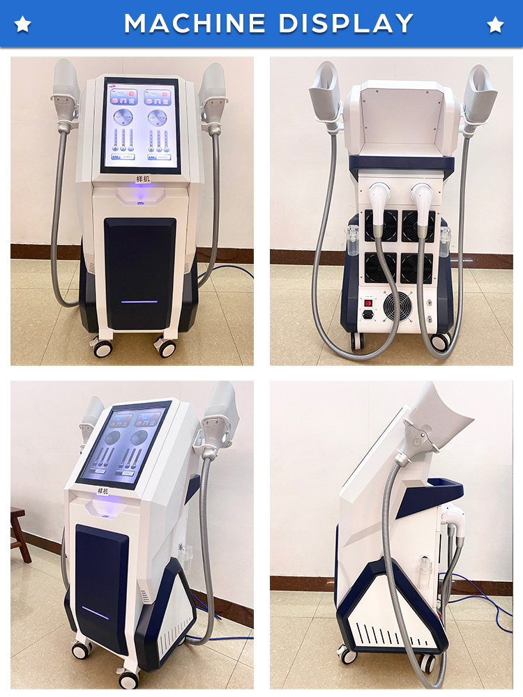 cryolipolysis criolipolisis