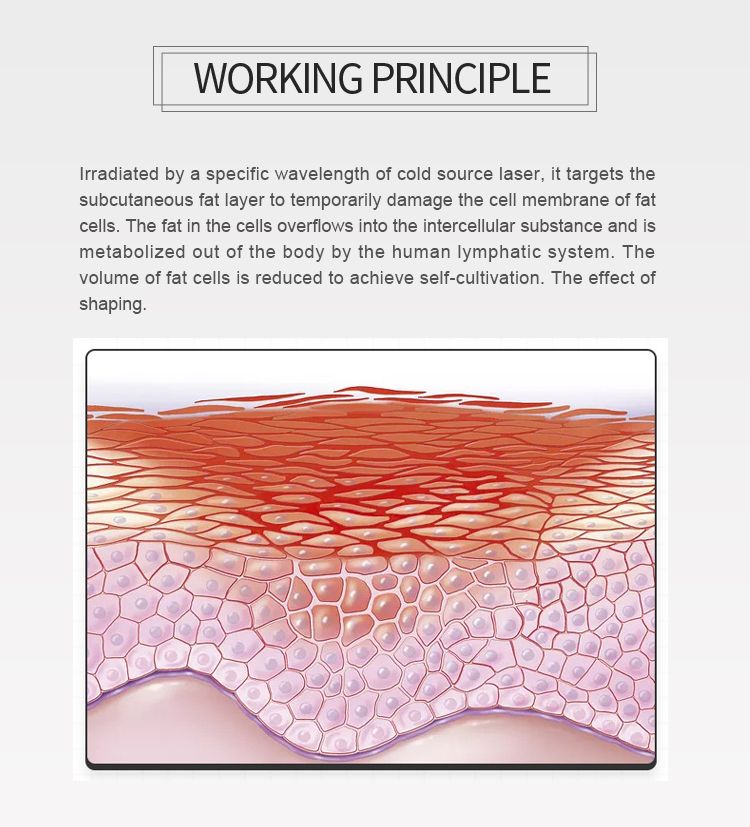 6d laser cryolipolysis