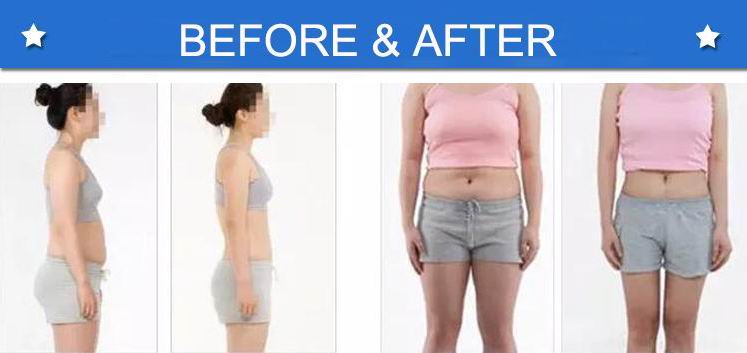 pressotherapy lymph drainage