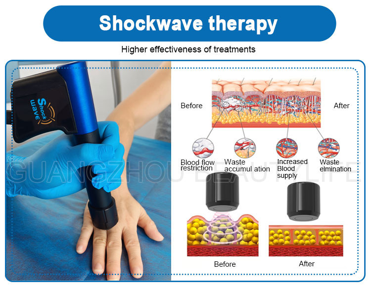 pmst neo therapy machine