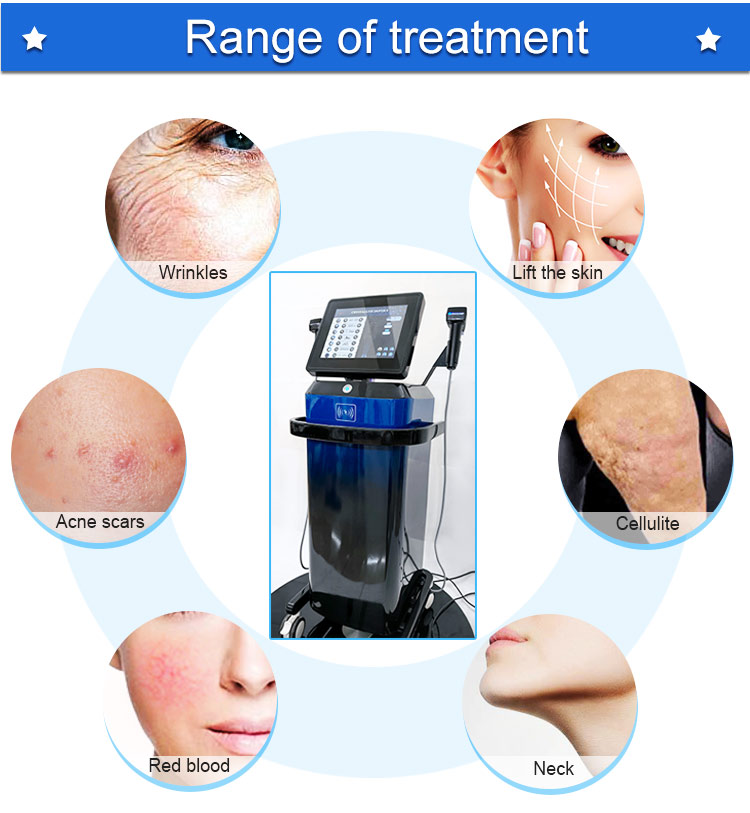 morpheus8 rf machine