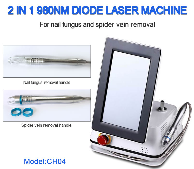 Nail fungus laser