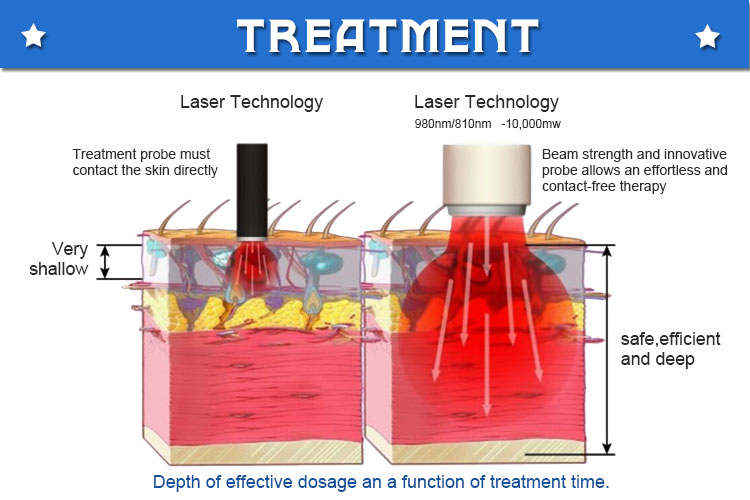 laser therapy for pain