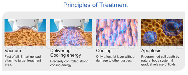 cryolipolysis treatment