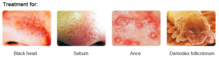 facial skin care machine