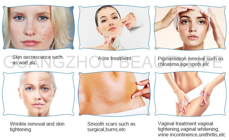 laser beauty machine