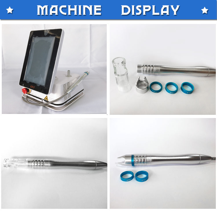 laser nail fungus treatment laser