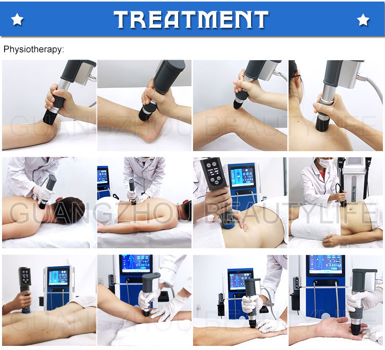 eswt shockwave therapy