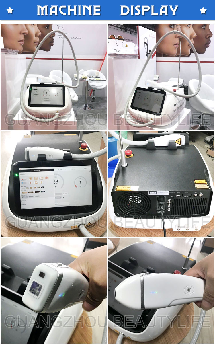 fibre coupled diode laser