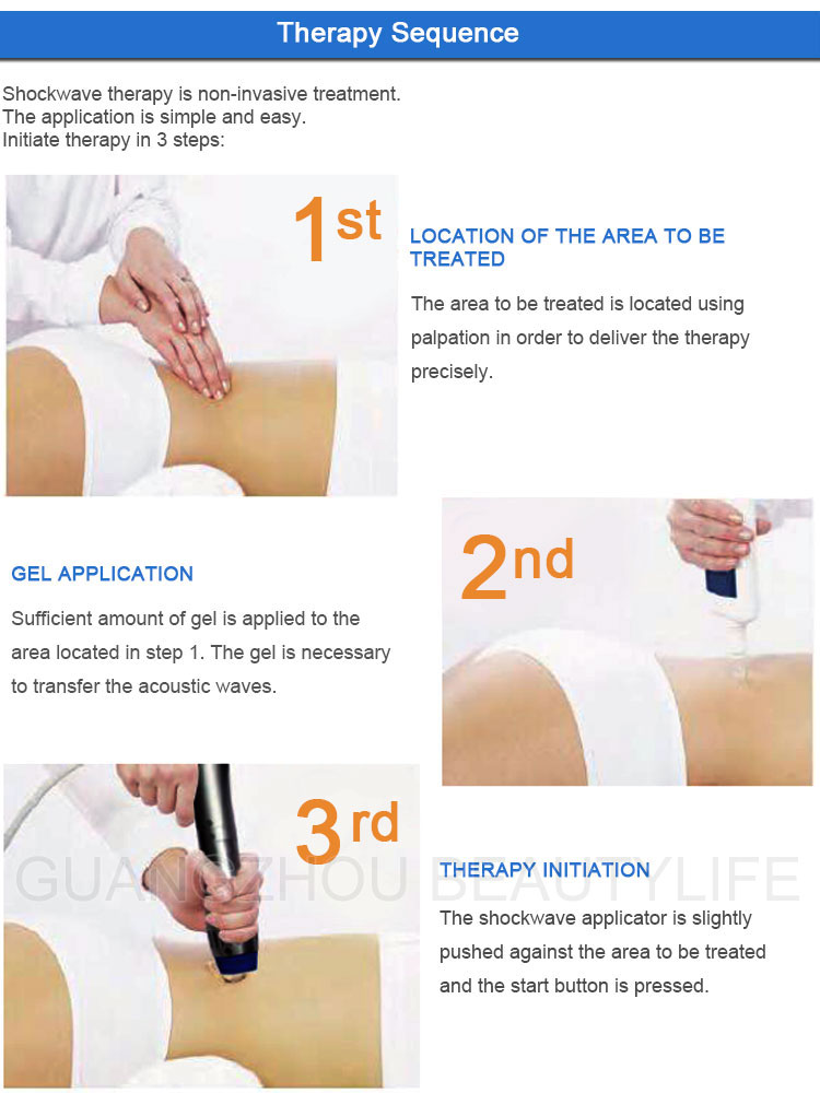 shockwave therapy step
