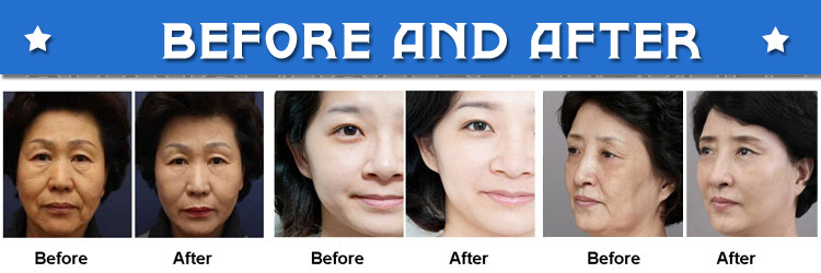 facial skin care machine